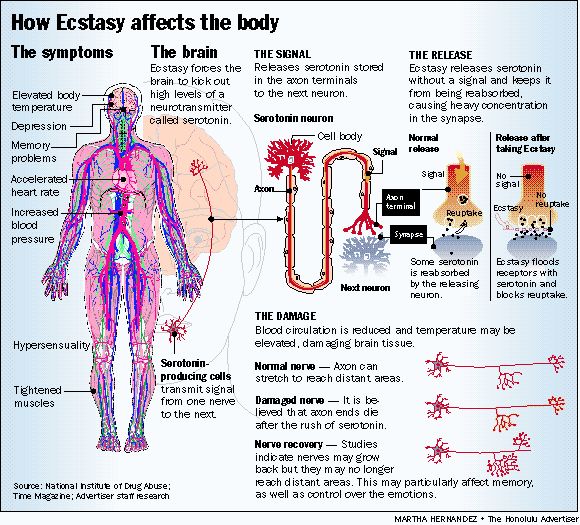 effects-of-ecstasy-to-the-brain-and-body